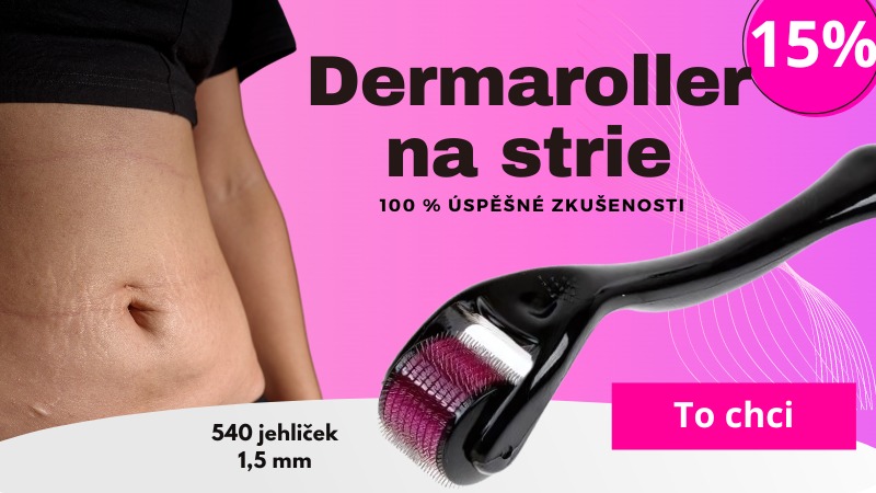 Dermaroller na strie na břiše – 540 jehliček, 1,5 mm, účinné mikrojehličkování pro redukci strií, 100% úspěšné výsledky, 15% sleva.